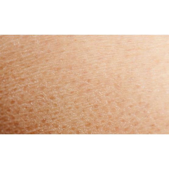 Kerato-regulating (ingrown hair)